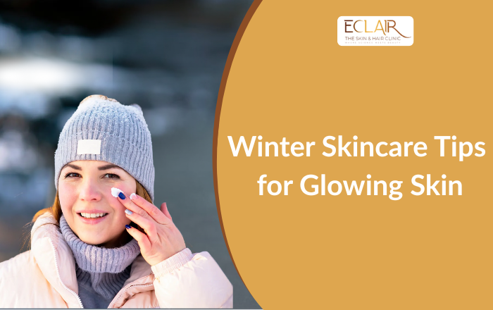 Best Winter Skincare Tips for Soft, Glowing Skin