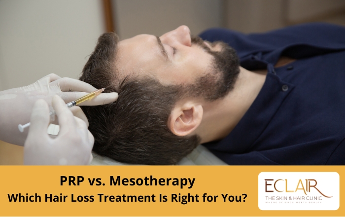 PRP vs. Mesotherapy : Comparison