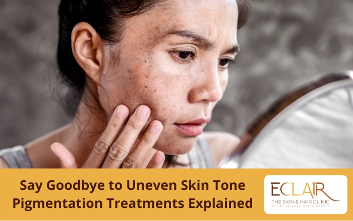 Pigmentation Treatment