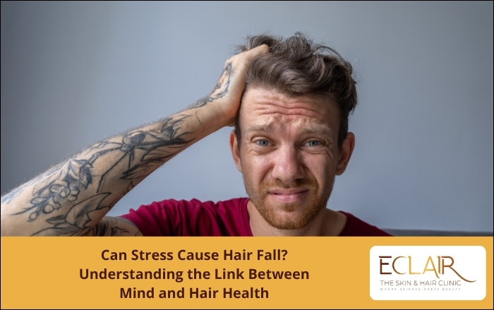 Stress and hairfall connection