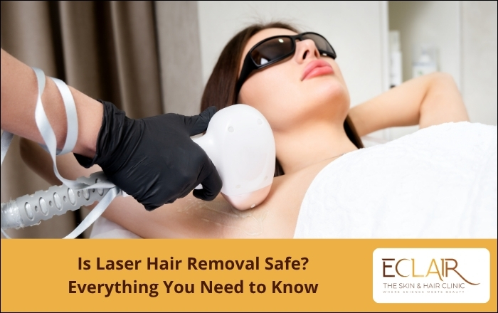 Laser Hair Removal Treatment