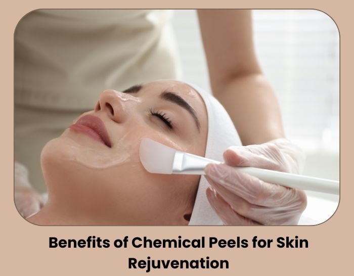 Benefits of Chemical Peels for Skin Rejuvenation